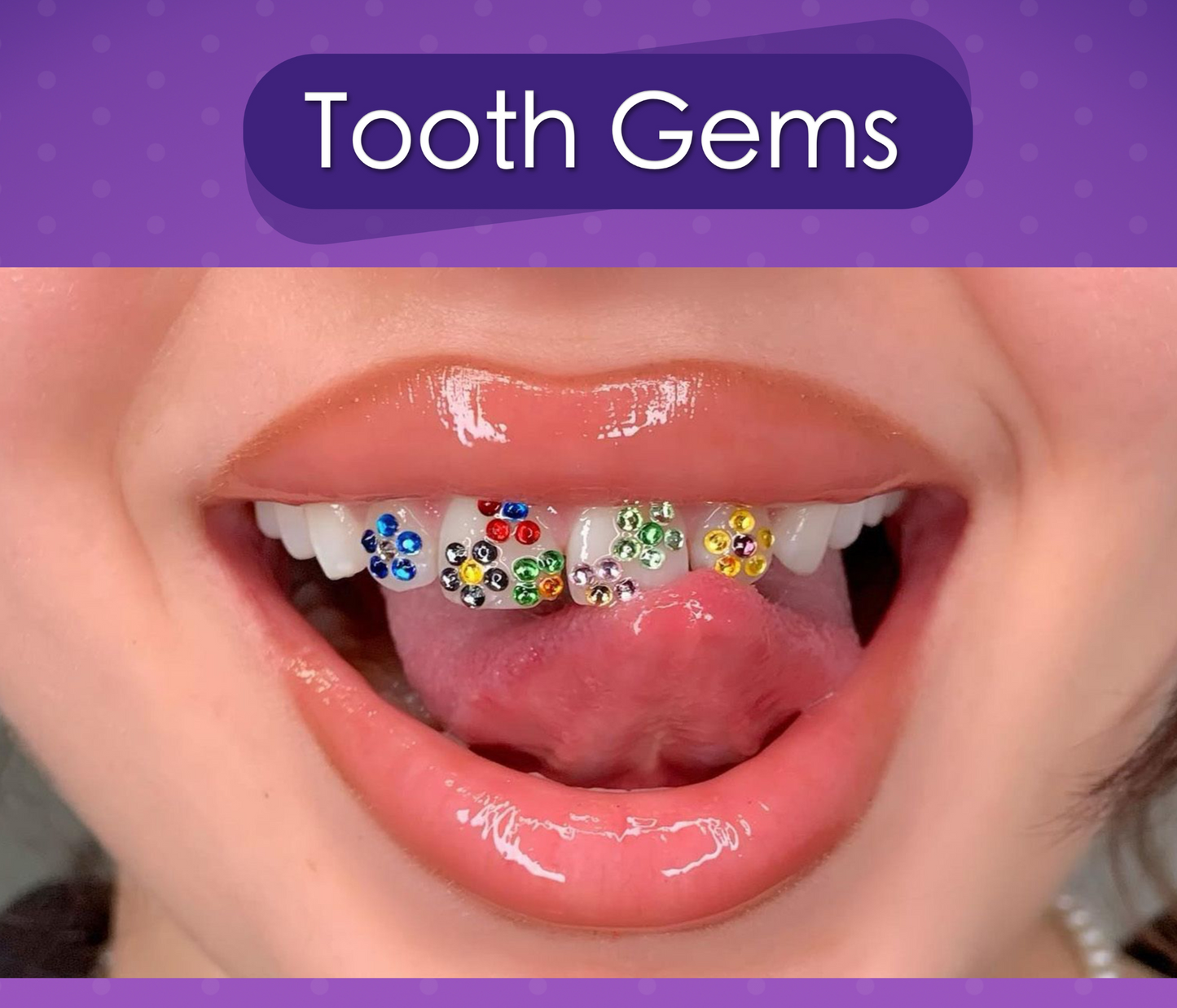 Orthodontic Braces Adhesive - Tooth Gem glue - Light Cure - Permanent Tooth  Gem Flowable Composite for Dentist